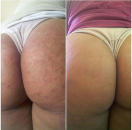 bumbum.jpg