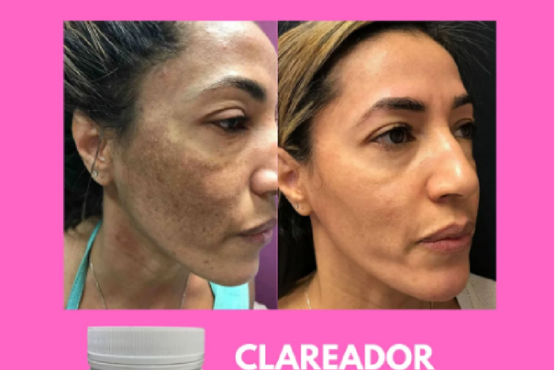 artes-site-clareador-de-manchas-08.png